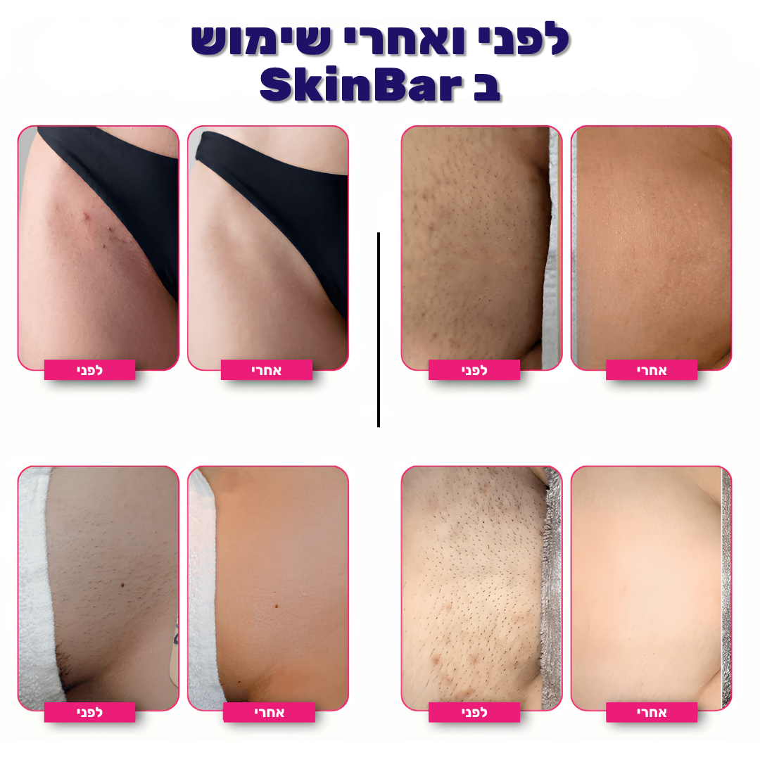 SkinBar™ | גילוח חלק לנשים