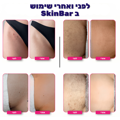 SkinBar™ | גילוח חלק לנשים