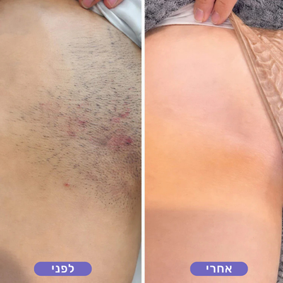 מעיין ד.