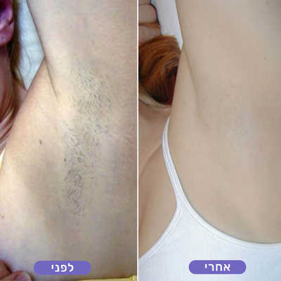 אופיר א.