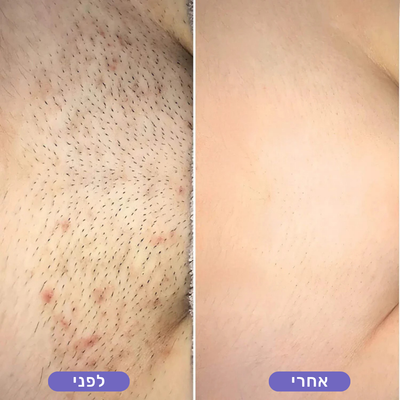 אלין מ.